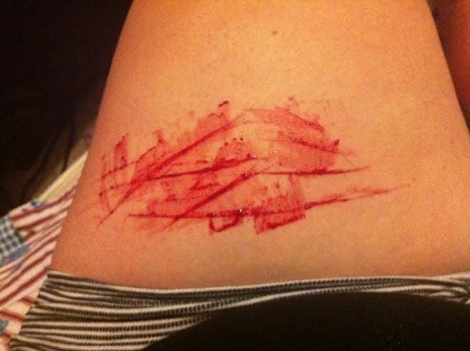 pic Cuts On Thighs With Blade