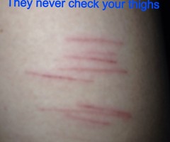 picture Razor Cuts On Thighs